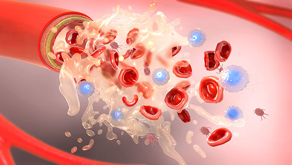 high blood viscosity high blood viscosity